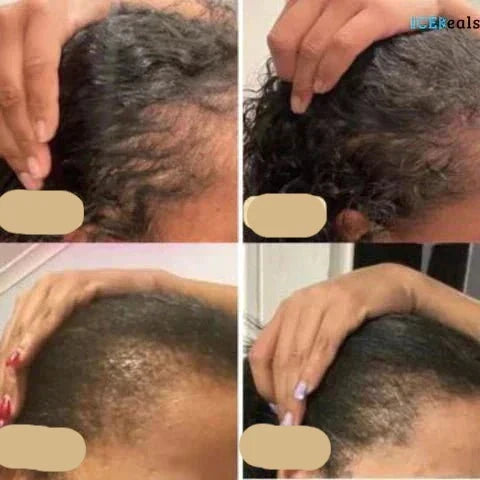 Vegans Hair Growth Oil – Natural Hair Growth Booster for Fuller Hair