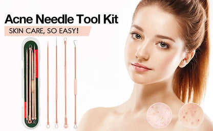 Professional Blackhead and Pimple Removal Set for Clear Skin