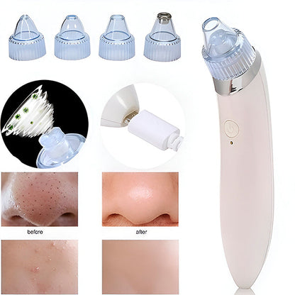 2-in-1 Pore Cleanser and Microdermabrasion Device for Smooth Skin