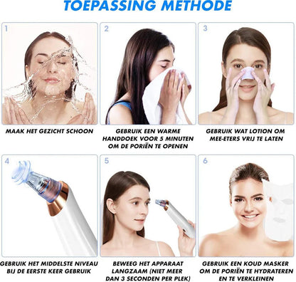 Blackhead Remover Vacuum – Multifunctional Pore Cleaner
