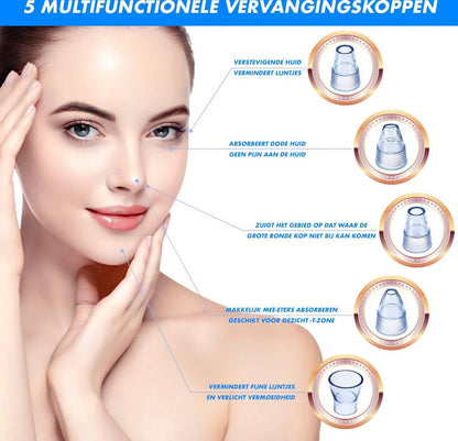 Blackhead Remover Vacuum – Multifunctional Pore Cleaner