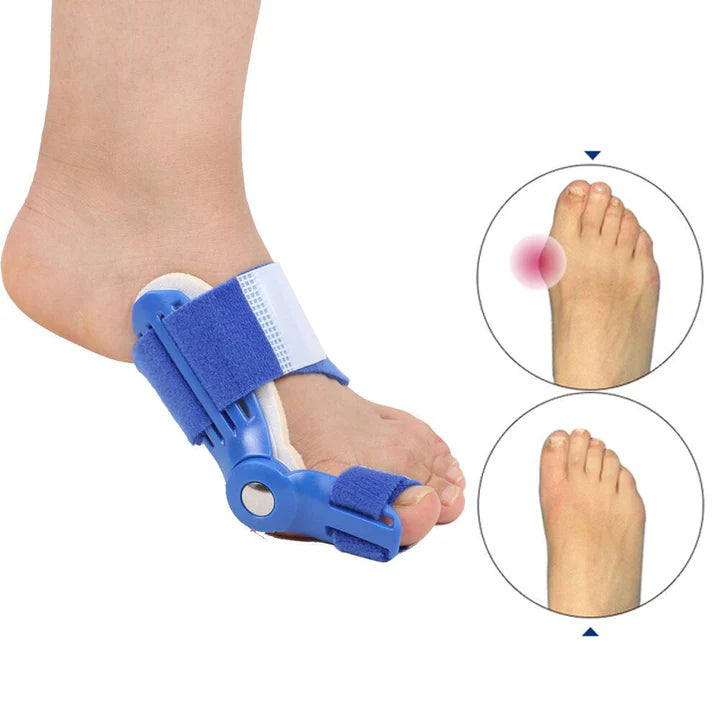 Orthopedic Hallux Valgus Splint (1 Pair)