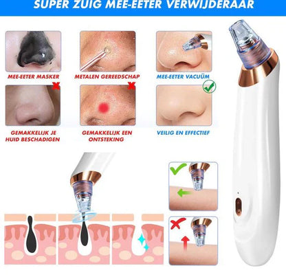 Blackhead Remover Vacuum – Multifunctional Pore Cleaner