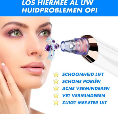 Blackhead Remover Vacuum – Multifunctional Pore Cleaner