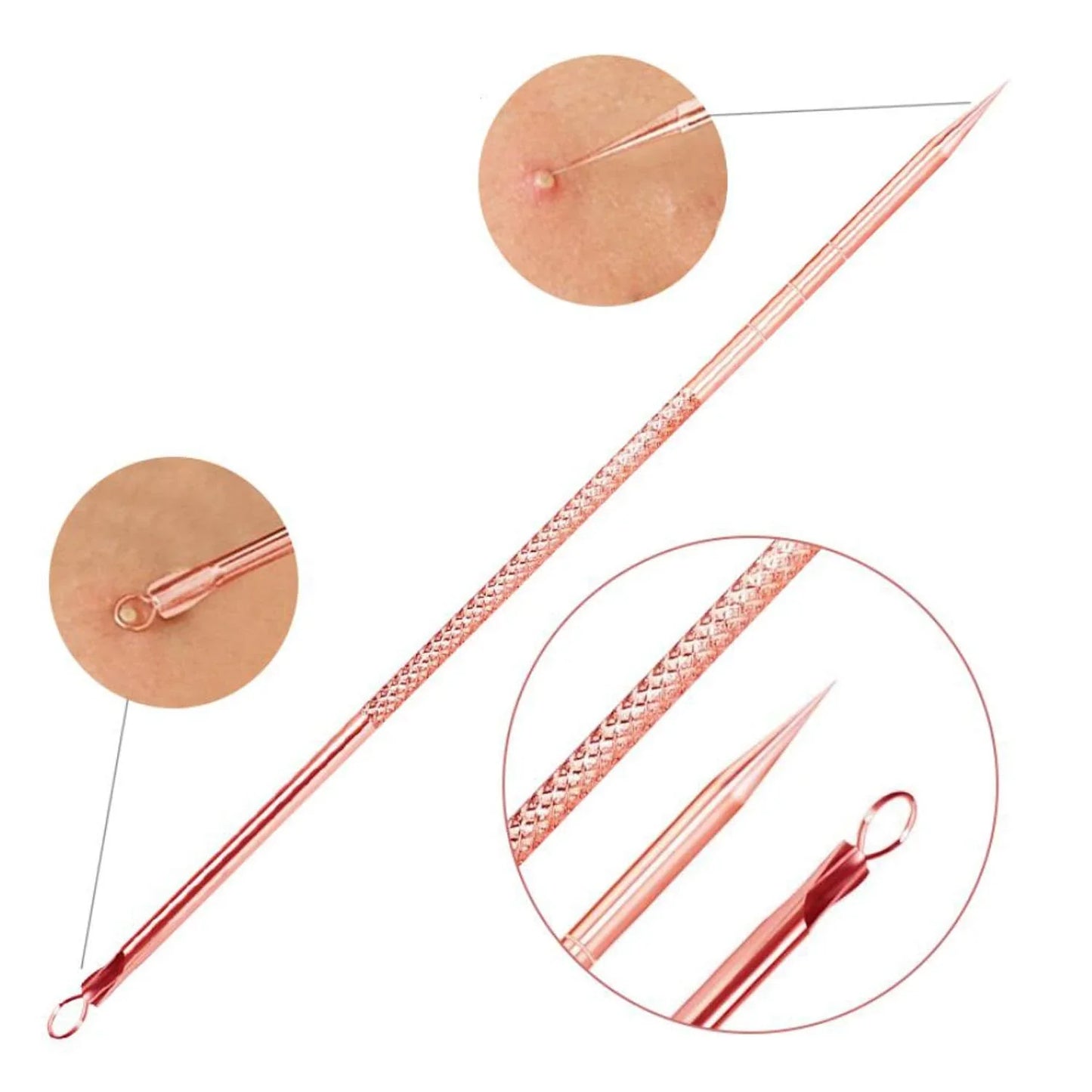 Professional Blackhead and Pimple Removal Set for Clear Skin