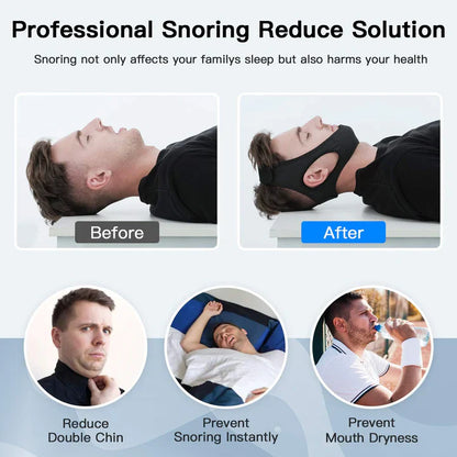 Anti-Snoring Chin Strap – Adjustable Snoring Stopper for Peaceful Sleep