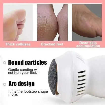 Electric Callus Remover for Feet – Professional Care Device for Smooth Skin