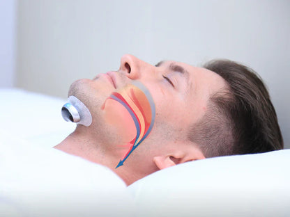 Anti-Snoring Device – Electronic Device for Restful Sleep