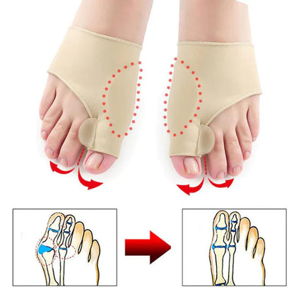 Hallux Valgus Corrective Support (1 Pair) – Effective Protection for Your Feet
