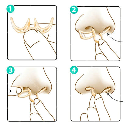 Comfortable Anti-Snoring Aid for Better Sleep