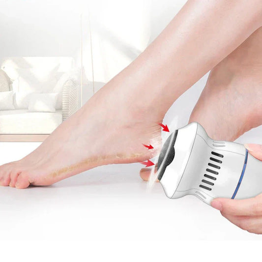 Electric Callus Remover for Feet – Professional Care Device for Smooth Skin