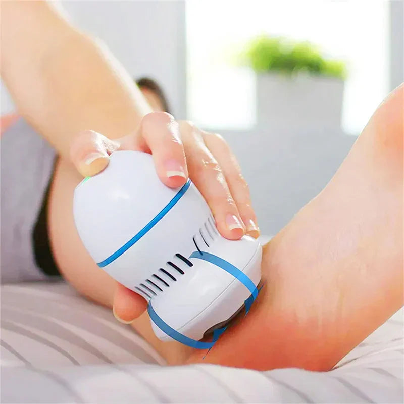 Electric Callus Remover for Feet – Professional Care Device for Smooth Skin