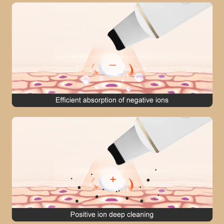 Ultrasonic Skin Scrubber for Deep Cleansing – Pore Cleaner & Facial Peeling with Ion Technology