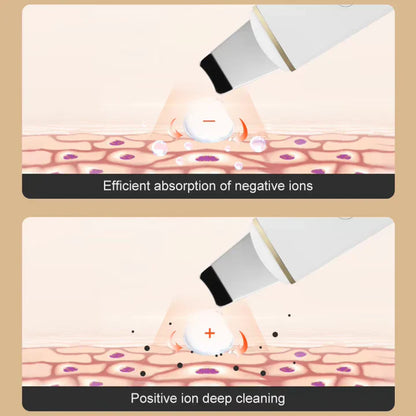 Ultrasonic Skin Scrubber for Deep Cleansing – Pore Cleaner & Facial Peeling with Ion Technology