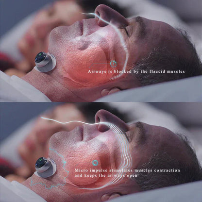 Slim Anti-Snoring Device for Restful Sleep