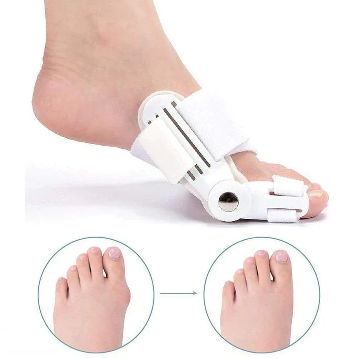 Orthopedic Hallux Valgus Splint (1 Pair)