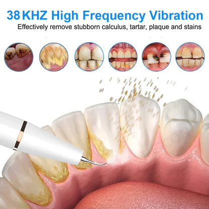 Rechargeable Electric Tooth Cleaner with 3 Modes