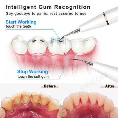 Rechargeable Electric Tooth Cleaner with 3 Modes