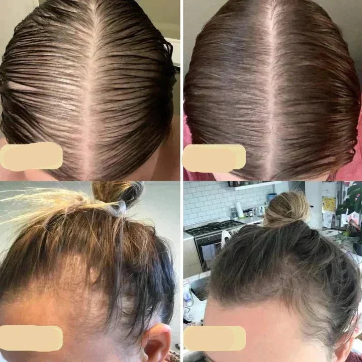 Vegans Hair Growth Oil – Natural Hair Growth Booster for Fuller Hair