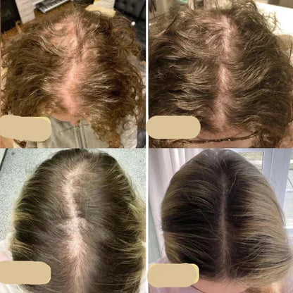 Vegans Hair Growth Oil – Natural Hair Growth Booster for Fuller Hair